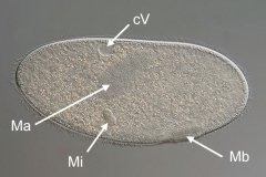 Frontonia leucas (1)