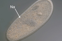 Frontonia leucas (2)