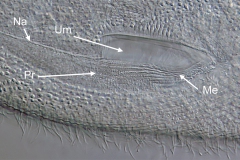Frontonia leucas (3)