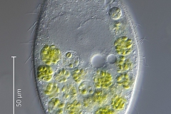 Colpidium colpoda