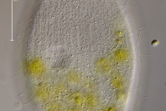Colpidium colpoda
