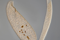 Loxodes magnus und Spirostomum ambiguum