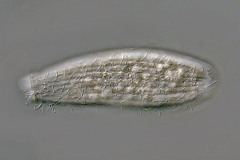 Spathidium muscicola
