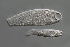 Spathidium muscicola und eine weitere Spathidium-Art