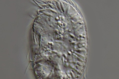 MT-Leptopharynx-costatus - 375-µm