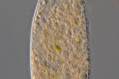 Spathidium sp.
