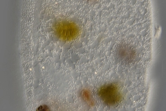 Frontonia leucas (4)