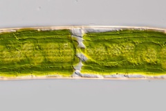 Closterium costatum (2)