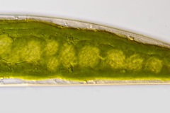 Closterium costatum (4)