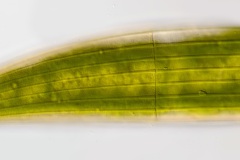 Closterium costatum (3)