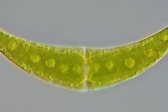 Closterium moniliferum - 205x43 µm