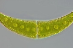 Closterium moniliferum