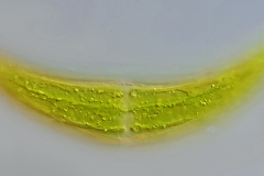 Closterium moniliferum