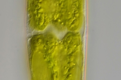 Closterium sublaterale (1)