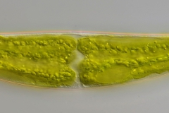 Closterium sublaterale (1)
