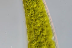 Closterium sublaterale (2)