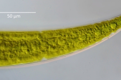 Closterium sublaterale (2)