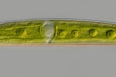Closterium littorale