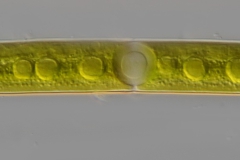 Closterium praelongum var. brevius