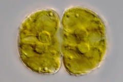 Cosmarium cf. obtusatum
