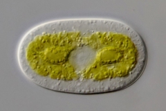 Cylindrocystis brebissoni