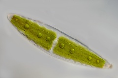  Closterium closterioides var. intermedium 