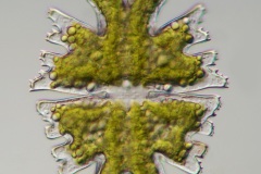Micrasterias americana