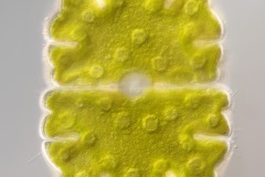 Micrasterias jenneri