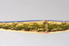 Closterium rostratum
