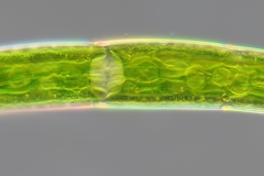Closterium striolatum