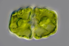 Euastrum cf. montanum