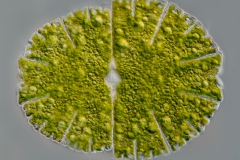 Micrasterias denticulata
