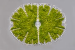 Micrasterias denticulata