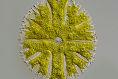 Micrasterias papillifera 1