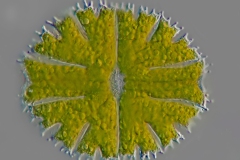 PLM-Micrasterias-papilliformis-01-130x150-µm-LD