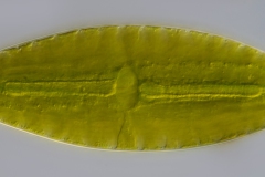 Netrium digitus