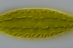 Netrium digitus