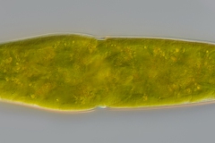 Pleurotaenium sp.