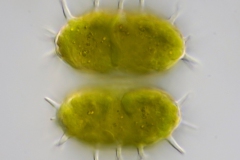 Staurastrum gladiosum