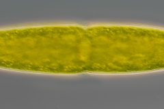 Tetmemorus granulatus