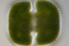 Cosmarium cf. reniforme