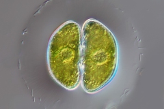 Cosmarium depressum var. intermedium