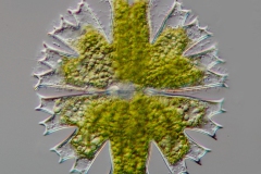 Micrasterias crux-melitensis