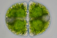 Cosmarium achydermum
