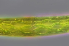 Closterium sp.