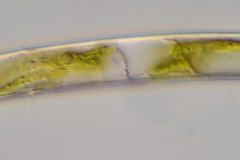 Closterium directcum