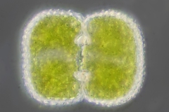 Cosmarium margaritatum