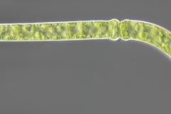 Pleurotaenium trabecula