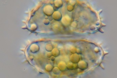 Staurastrum scabrum 1