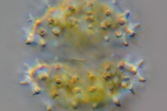 Staurastrum scabrum 2